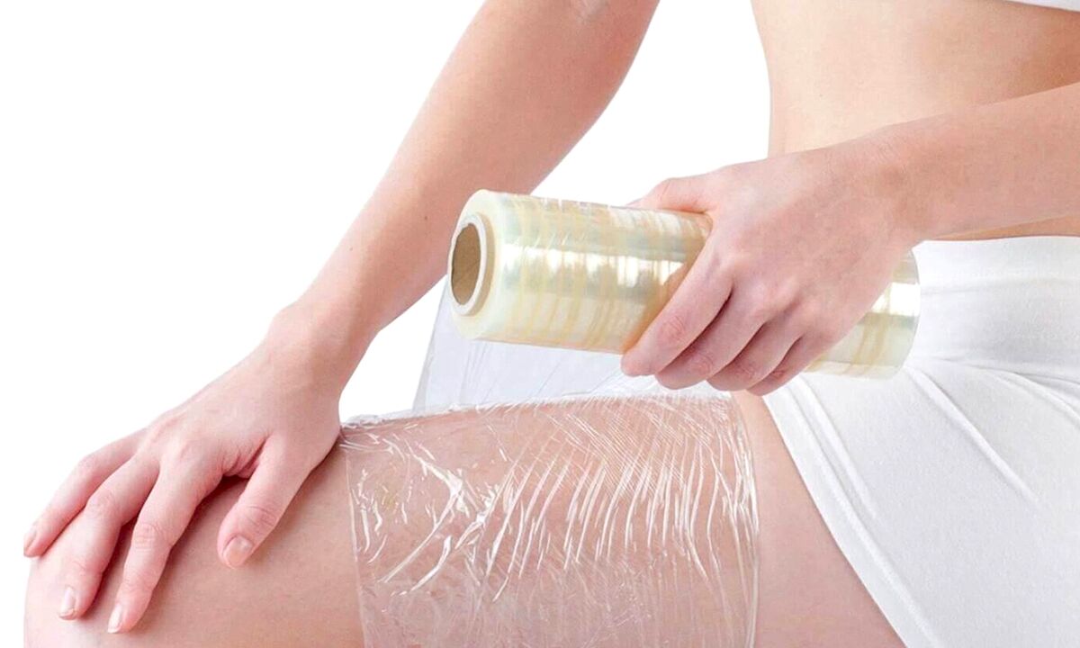 პროცედურები